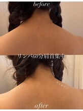 エル(Elle)/中周波×リンパマッサージ