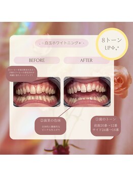 プラスビーセルフ(+b self)/ホワイトニングビフォーアフター