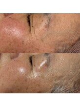 エス(S)/60代しわくすみ