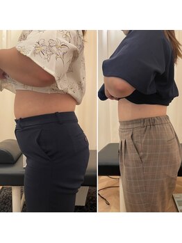 ナオ接骨院(NAO接骨院)/Before/After