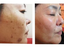 トータルビューティーサロン 凛/来るたびにキレイになる