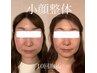 【小顔整体】長年の食いしばりからくるエラ張りでお悩みの方★初回体験4980円