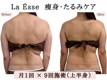 ラエッセ(La Esse)/背中を美しく パワーレメディ