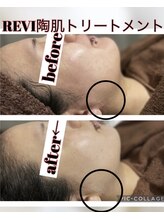サロンシャイン(Salon Shine)/REVI１回２０代女性