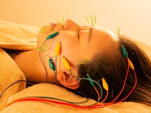 ハリ パール(HARI PEARL)/美容鍼/小顔・エラ張り