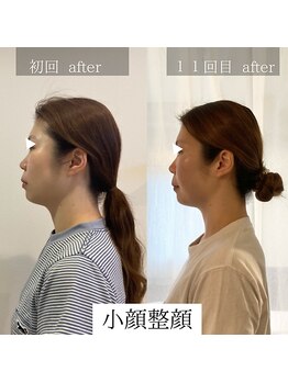 マシェリ(ma cherie)/小顔整顔ケア
