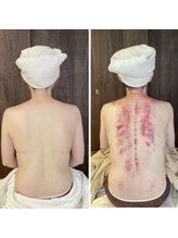 リュクス(Luxe)/ビフォーアフター（４0代）