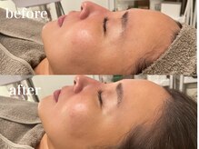 エンソワー(en'sower)/シェービングと毛穴洗浄