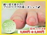 プレミアム☆目安：爪３枚【巻き爪補正！繰り返さない！】 15800→14800