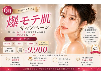 レディアンスの写真