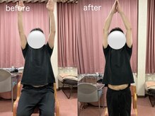 文京指圧/施術before／after