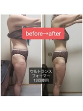 ラブリエ(Labriller)/ウルトラで劇的ビフォーアフター