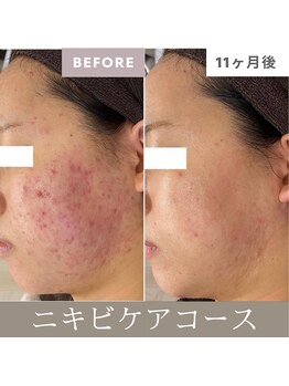 サードプレイス(3rd Place)/2階：エステ症例