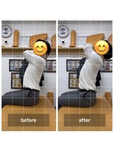 ナオル整体 飯田橋院(NAORU整体)/Before After/飯田橋/整体・矯正