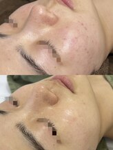 レイ(Lei)/自信のあるお肌へ！