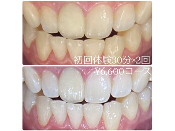 ホワイトニングルーム 横浜店(Whitening Room)/セルフホワイトニング/横浜
