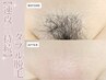 【WAX+光脱毛】その場でつるつる&効果長持ち♪VIOダブル脱毛 9,900円→
