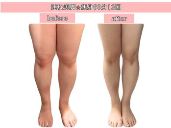 エステサロン ヴリエ 立川店/美脚★ハイパーナイフEX60分12回