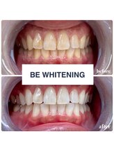 ビーホワイト 名古屋金山店(BE WHITE)/【ホワイトニング】8回回数券