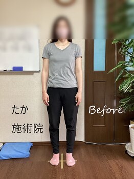 たか施術院/腰痛 関節の痛 めまい 初～1ヶ月