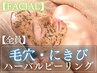 《毛穴・ニキビケア》むけるハーブ！ハーバルピール33,000円