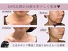 【40代～80代限定】 顔・首｜しわ改善・たるみケア3回 ¥69,600→¥49,800