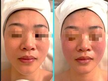 エムナチュラル 関内店(M Natural)/【肌のハリ艶アップ♪】