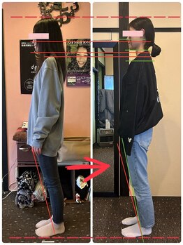 はあと/猫背もお任せ