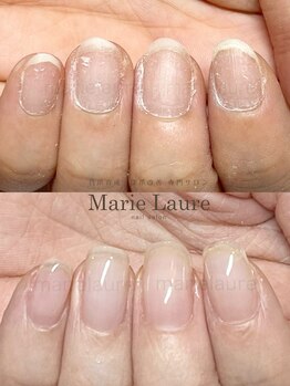 マリーロール 淀屋橋本店(Marie Laure)/自爪育成/深爪矯正/ネイルケア