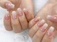 ティンク センター南 アイラッシュアンドネイル (Tink eyelash＆nail)の写真/巻き爪/深爪/チビ爪/反り爪/貝爪など爪の形にコンプレックスがある方、ネイルの持ちが悪い方に◎
