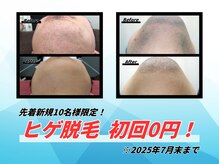 ダイアモンドベリー