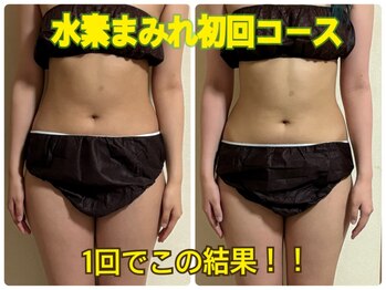 ヨサパーク ポノレア(YOSA PARK PONO-LEA)の写真/お腹、太ももが痩せたい！ルルオンならお腹と太ももから痩せる！