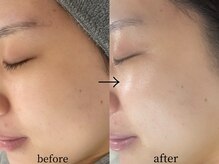 フェイシャルサロン アリイ(ALII)/