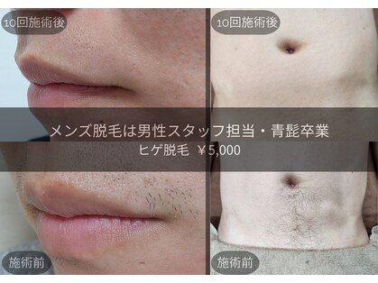 ティンクル サロン(Twinkle salon)の写真