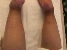 中国整体 らくらく堂/遠赤外線リンパケア脚セラピー