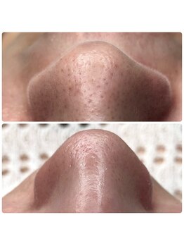 リンカ アオモリ(Rinka aomori)/フェイシャルワックス