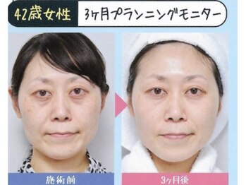 サロンド ユニバース(salon de universe)/メタジェクト大人気です★