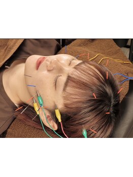 小顔になりたい