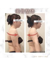 ミエル(Miel)/Before After