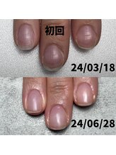 ココ(COCO)/見た目が変わる自爪育成