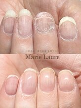 マリーロール 淀屋橋本店(Marie Laure)/自爪育成/深爪矯正/ネイルケア