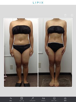 健康痩身研究所 蟹江店/ビフォーアフター