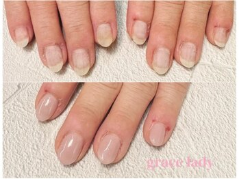 グレースレディ/理想の先細の爪へ