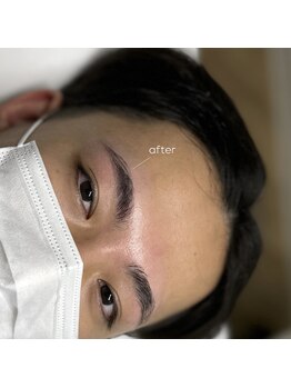 レアファースト/メンズハリウッドブロウリフト