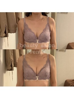 ヴィーナス(Venus)/バストアップ(痩身効果◎整体◎