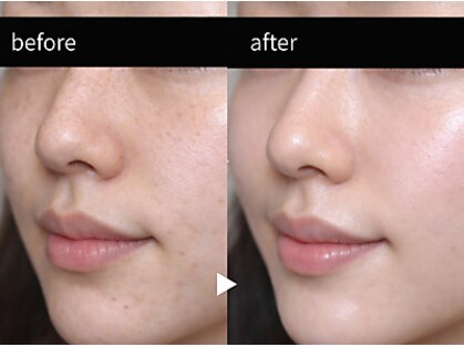 フルリールの写真