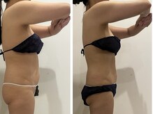 ビューティー アディクト(Beauty addict)の雰囲気（強力痩身マシン【セルゼロ】導入！5アタックでぜい肉を撃退☆）