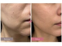 美容整骨小顔ラボの雰囲気（《たるみ・エイジングケア》豊富なマシンで最適な施術をご提案）