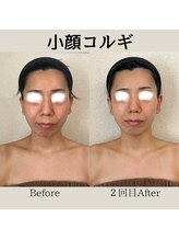 リーブル(LIBRE)/小顔コルギ　２回