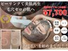 カーボンフェイシャルその都度払い